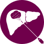 CABOMETYX Liver Ablation icon